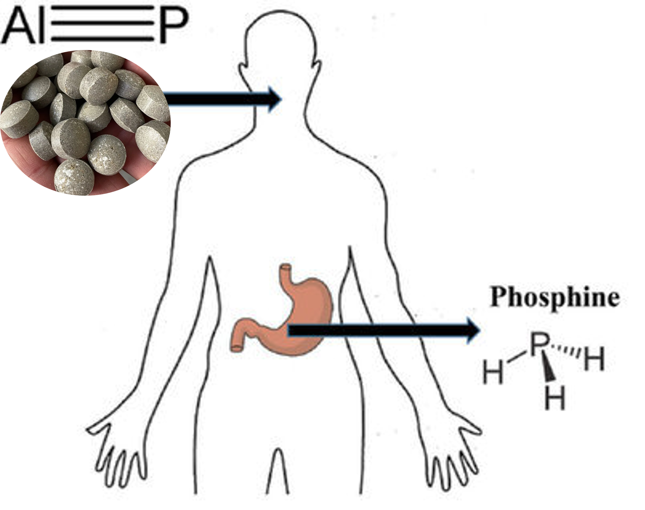 مسمومیت با قرص برنج